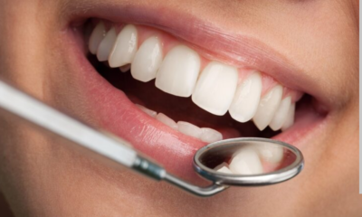 when do your wisdom teeth come in