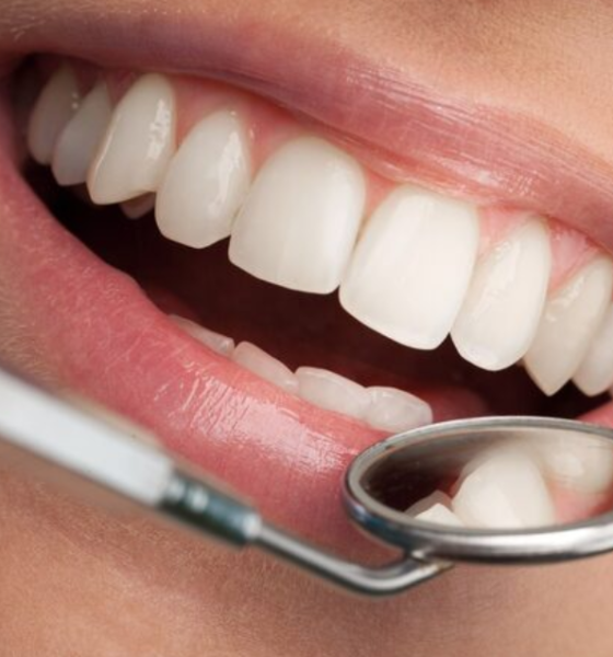 when do your wisdom teeth come in