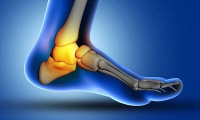 how to tell if your foot is broken